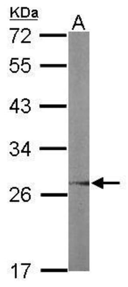 Invitrogen UBC3B Polyclonal Antibody 100 &mu;L; Unconjugated:Antibodies,