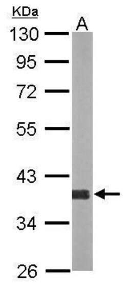 Invitrogen AKR1D1 Polyclonal Antibody 100 &mu;L; Unconjugated:Anticuerpos