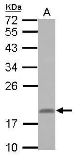 Invitrogen RNF181 Polyclonal Antibody 100 &mu;L | Buy Online | Invitrogen&trade; | Fisher Scientific