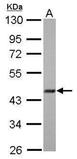 Invitrogen FBXO22 Polyclonal Antibody 100 &mu;L; Unconjugated:Antibodies,
