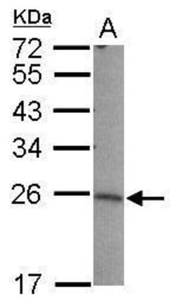 Invitrogen LIN7B Polyclonal Antibody 100 &mu;L; Unconjugated:Antibodies,