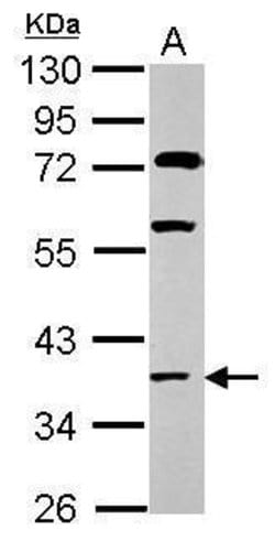 Invitrogen HOXC13 Polyclonal Antibody 100 &mu;L; Unconjugated:Antibodies,