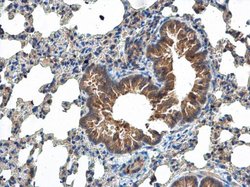 Invitrogen MCTS1 Polyclonal Antibody 100 &mu;L; Unconjugated:Antibodies,