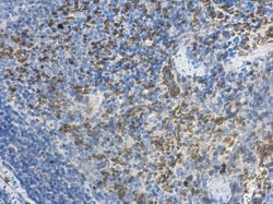 Invitrogen MCTS1 Polyclonal Antibody 100 &mu;L; Unconjugated:Antibodies,