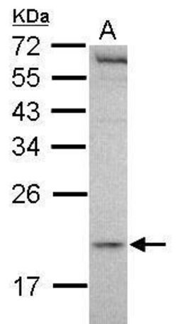 Invitrogen MCTS1 Polyclonal Antibody 100 &mu;L; Unconjugated:Antibodies,