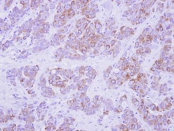Invitrogen Cytokeratin 2e Polyclonal Antibody 100 &mu;L | Buy Online | Invitrogen&trade; | Fisher Scientific