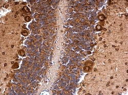 Invitrogen MSI2 Polyclonal Antibody 100 &mu;L; Unconjugated:Antibodies,
