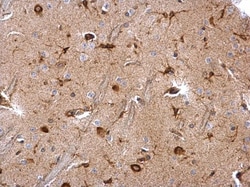 Invitrogen MSI2 Polyclonal Antibody 100 &mu;L; Unconjugated:Antibodies,
