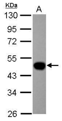 Invitrogen LEFTY Polyclonal Antibody 100 &mu;L; Unconjugated:Antibodies,