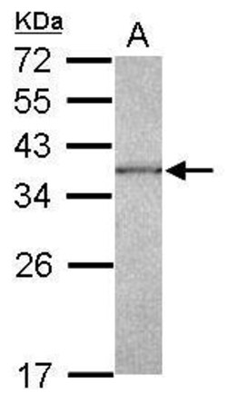 Invitrogen CAPZA1 Polyclonal Antibody 100 &mu;L; Unconjugated:Antibodies,