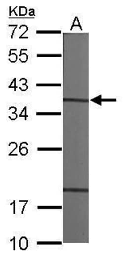 Invitrogen CAPZA1 Polyclonal Antibody 100 &mu;L; Unconjugated:Antibodies,