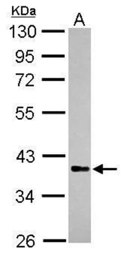 Invitrogen RFFL Polyclonal Antibody 100 &mu;L; Unconjugated:Antibodies,