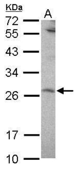 Invitrogen SENP8 Polyclonal Antibody 100 &mu;L; Unconjugated:Antibodies,