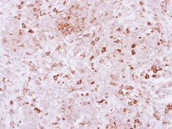 Invitrogen SPRED2 Polyclonal Antibody 100 μL; Unconjugated:Antibodies,
