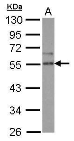 Invitrogen SPRED2 Polyclonal Antibody 100 μL; Unconjugated:Antibodies,