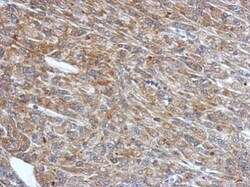 Invitrogen RNF133 Polyclonal Antibody 100 &mu;L | Buy Online | Invitrogen&trade; | Fisher Scientific