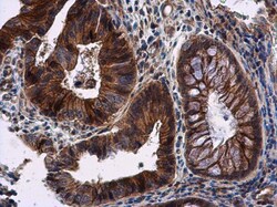 Invitrogen RNF133 Polyclonal Antibody 100 &mu;L | Buy Online | Invitrogen&trade; | Fisher Scientific