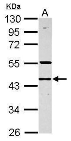 Invitrogen RNF133 Polyclonal Antibody 100 &mu;L | Buy Online | Invitrogen&trade; | Fisher Scientific