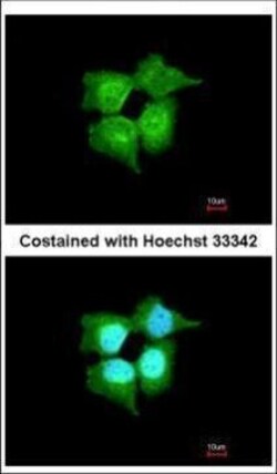 Invitrogen RABL6 Polyclonal Antibody 100 &mu;L | Buy Online | Invitrogen&trade; | Fisher Scientific