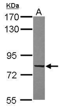 Invitrogen RABL6 Polyclonal Antibody 100 &mu;L; Unconjugated:Antibodies,