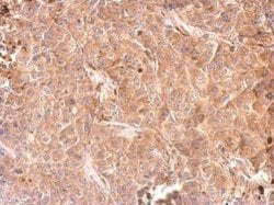 Invitrogen&trade;&nbsp;GPD1 Polyclonal Antibody