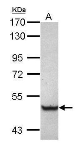 Invitrogen TRIM68 Polyclonal Antibody 100 &mu;L; Unconjugated:Antibodies,