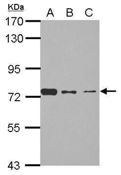 Invitrogen SENP3 Polyclonal Antibody 100 &mu;L; Unconjugated:Antibodies,