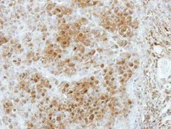 Invitrogen SLC4A1AP Polyclonal Antibody 100 &mu;L; Unconjugated:Antibodies,