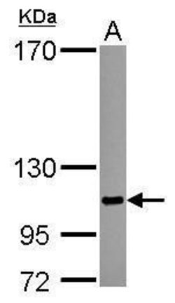 Invitrogen SENP5 Polyclonal Antibody 100 &mu;L; Unconjugated:Antibodies,