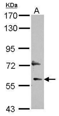 Invitrogen DEPDC7 Polyclonal Antibody 100 &mu;L; Unconjugated:Antibodies,