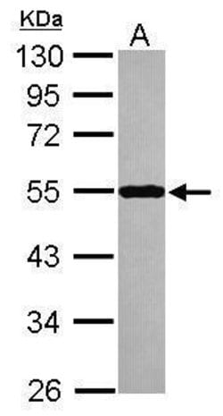 Invitrogen Septin-10 Polyclonal Antibody 100 &mu;L | Buy Online | Invitrogen&trade; | Fisher Scientific