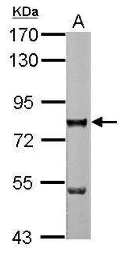Invitrogen ZNF179 Polyclonal Antibody 100 &mu;L | Buy Online | Invitrogen&trade; | Fisher Scientific