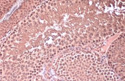 Invitrogen HOXC10 Polyclonal Antibody 100 μL; Unconjugated:Antibodies,
