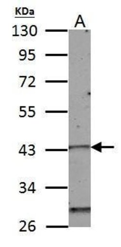 Invitrogen HOXC10 Polyclonal Antibody 100 μL; Unconjugated:Antibodies,