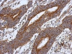 Invitrogen HS3ST2 Polyclonal Antibody 100 &mu;L; Unconjugated:Antibodies,