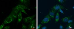 Invitrogen PRELID1 Polyclonal Antibody 100 &mu;L; Unconjugated:Antibodies,