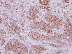 Invitrogen PRELID1 Polyclonal Antibody 100 &mu;L; Unconjugated:Antibodies,