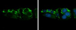 Invitrogen Arginase 2 Polyclonal Antibody 100 &mu;L; Unconjugated:Antibodies,