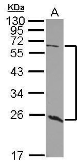 Invitrogen GALNT9 Polyclonal Antibody 100 &mu;L; Unconjugated:Antibodies,