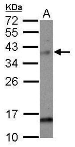Invitrogen MAD2L1BP Polyclonal Antibody 100 &mu;L; Unconjugated:Antibodies,