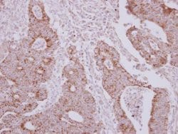 Invitrogen NARS2 Polyclonal Antibody 100 &mu;L; Unconjugated:Antibodies,