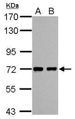 Invitrogen HCC1 Polyclonal Antibody 100 &mu;L; Unconjugated:Antibodies,