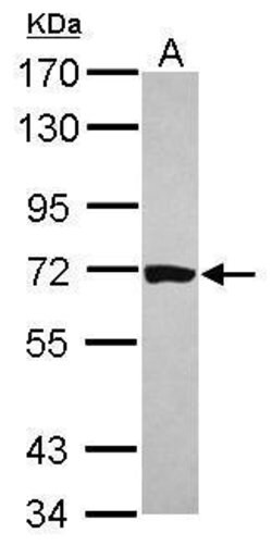 Invitrogen HCC1 Polyclonal Antibody 100 &mu;L; Unconjugated:Antibodies,