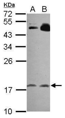 Invitrogen RGS8 Polyclonal Antibody 100 &mu;L; Unconjugated:Antibodies,