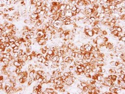 Invitrogen Calpain S1 Polyclonal Antibody 100 &mu;L; Unconjugated:Antibodies,