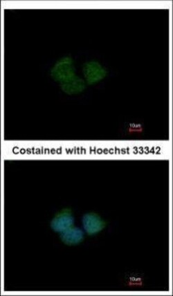 Invitrogen ENC-2 Polyclonal Antibody 100 μL; Unconjugated:Antibodies,