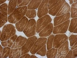 Invitrogen ENC-2 Polyclonal Antibody 100 μL; Unconjugated:Antibodies,