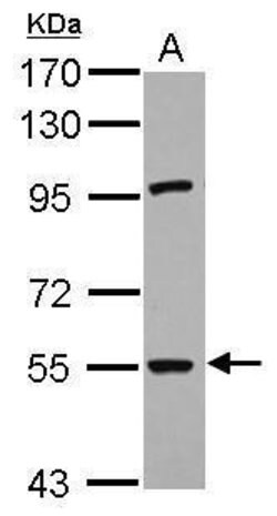 Invitrogen RNF168 Polyclonal Antibody 100 &mu;L; Unconjugated:Antibodies,