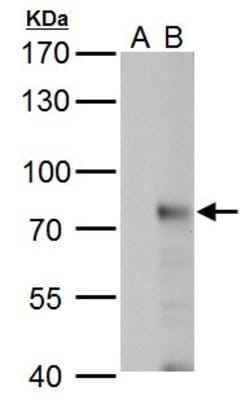 Invitrogen RNF168 Polyclonal Antibody 100 &mu;L; Unconjugated:Antibodies,