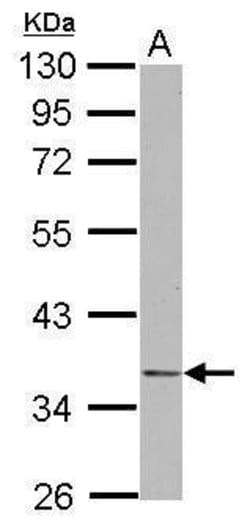 Invitrogen NDE1 Polyclonal Antibody 100 &mu;L | Buy Online | Invitrogen&trade; | Fisher Scientific